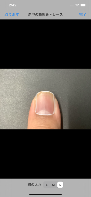Derma Photo(圖4)-速報App