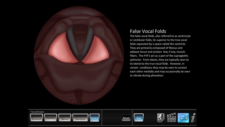 Paresis/Paralysis screenshot-3
