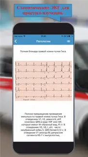 ЭКГ: Расшифровка и тесты. lite айфон картинки 1