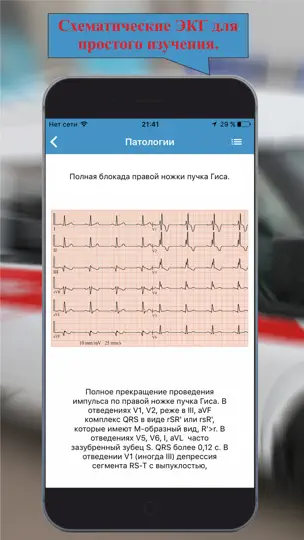 Скриншот ЭКГ: Расшифровка и тесты. Lite на iPhone 1