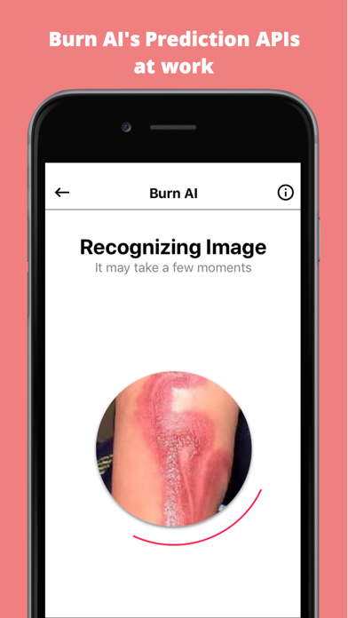 Screenshot #2 pour Burn AI