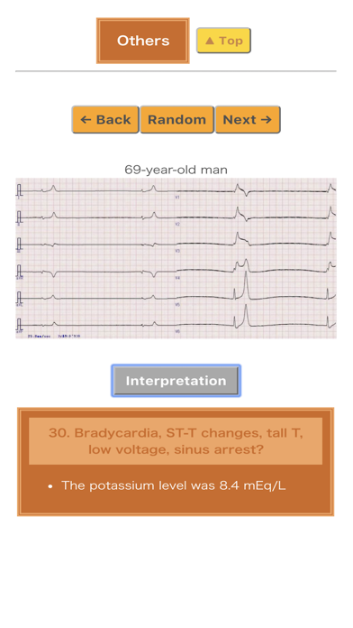 Pocket ECGのおすすめ画像7