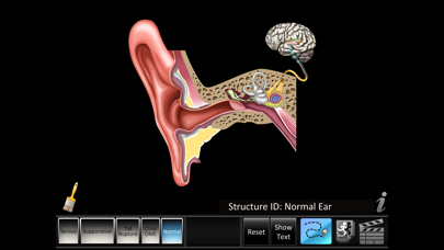 Screenshot #1 pour Otitis Media Disorders