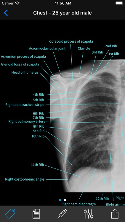 Normal X-Rays and Real Cases