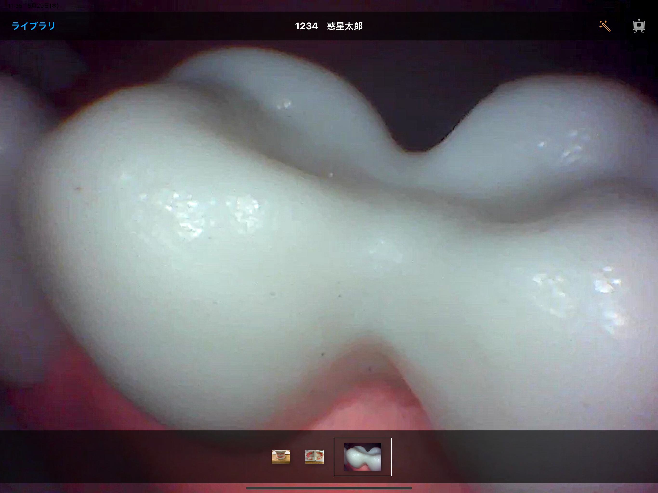 DentalShot screenshot 7