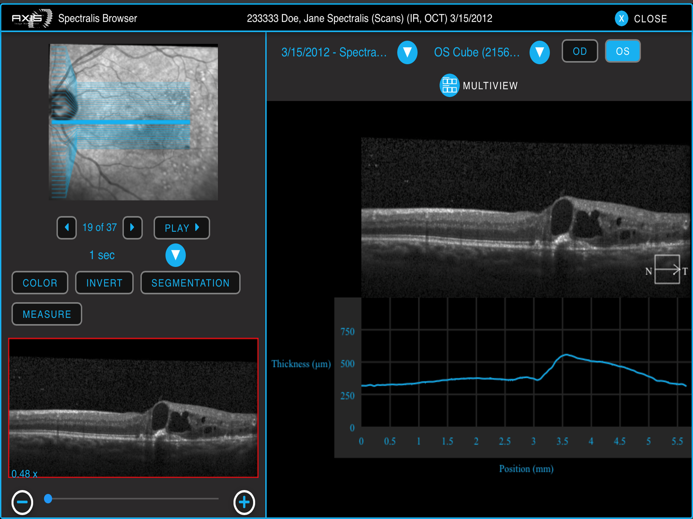 Axis Image Management screenshot 3
