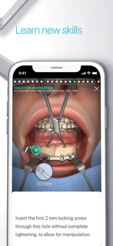 Captura 3 Touch Surgery: Surgical Videos iphone