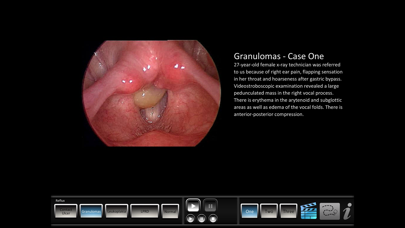 Vocal Pathology: Reflux Screenshot