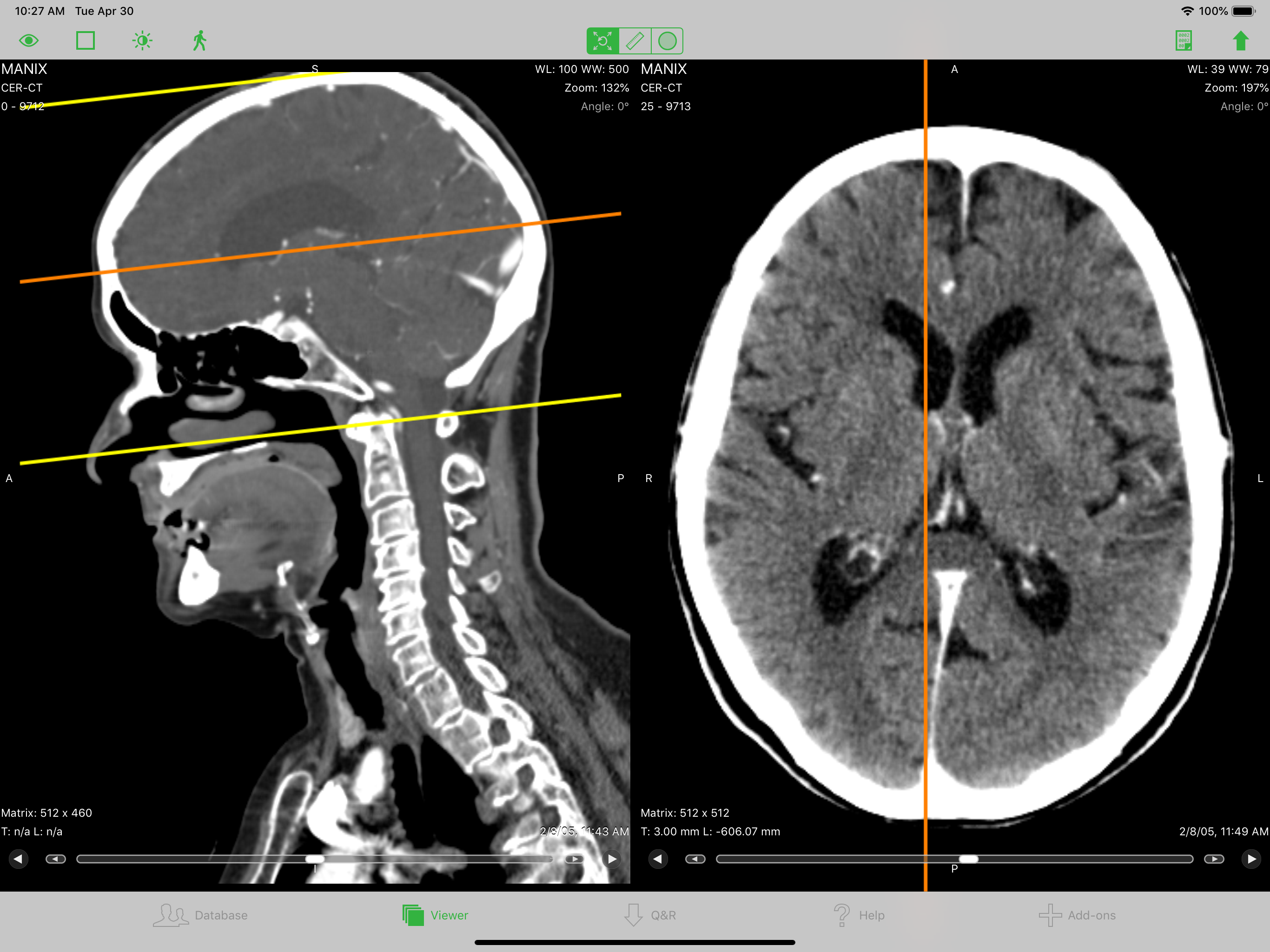 OsiriX HD screenshot 6