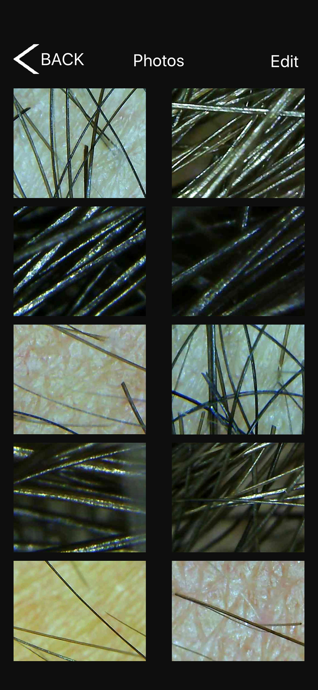 Tricho-derm profiler