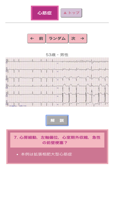 ポケット心電図のおすすめ画像6