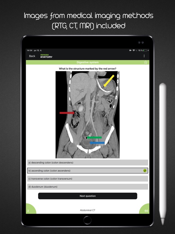 Memorix Anatomy QUIZ iPad screenshot 4 - Medical app