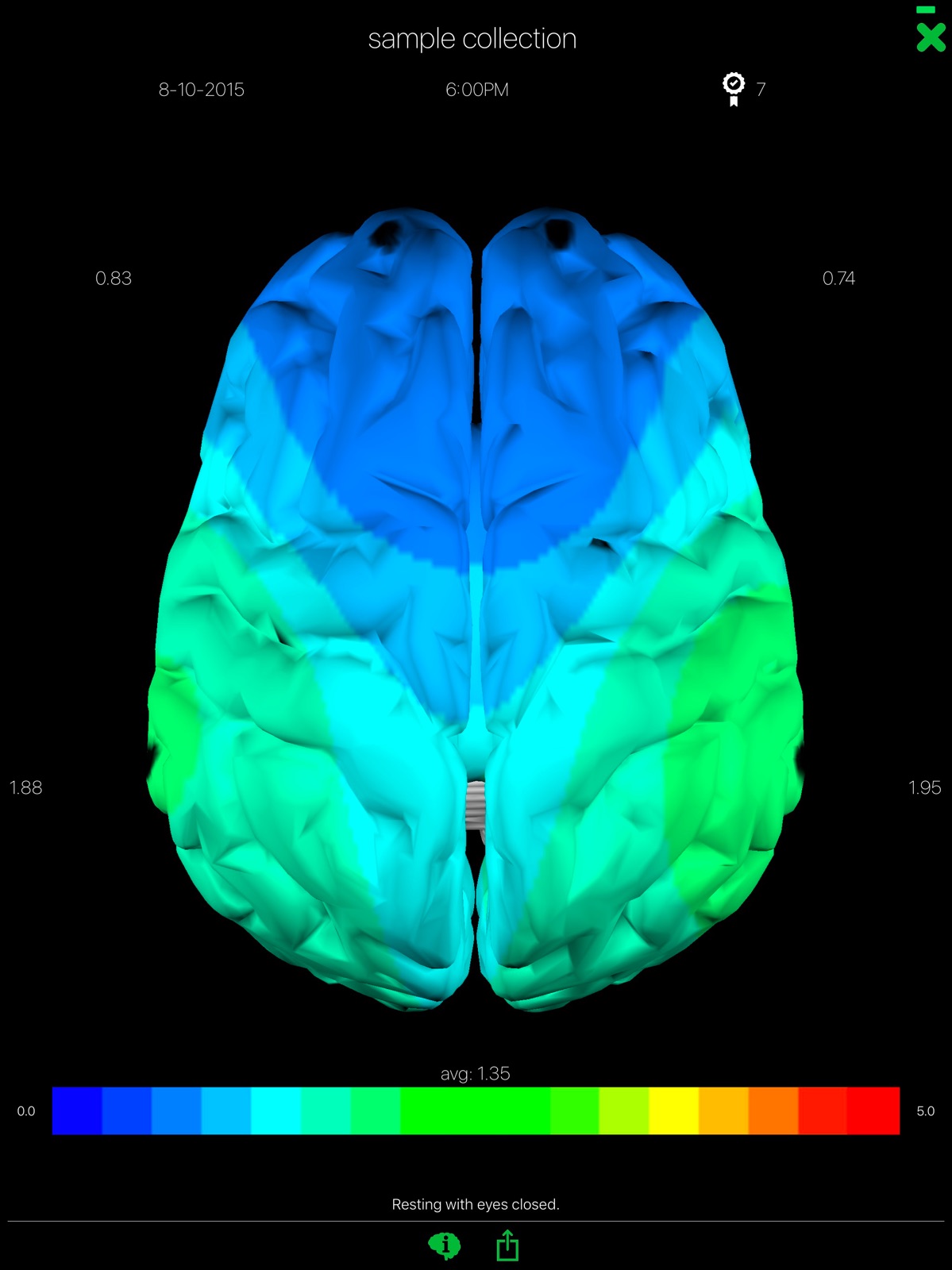 Opti Brain ipad screenshot 1