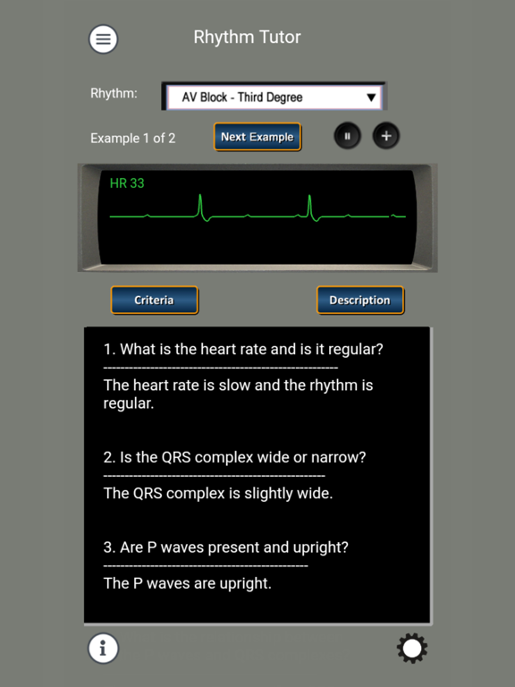 ECG Rhythms and ACLS Casesのおすすめ画像3