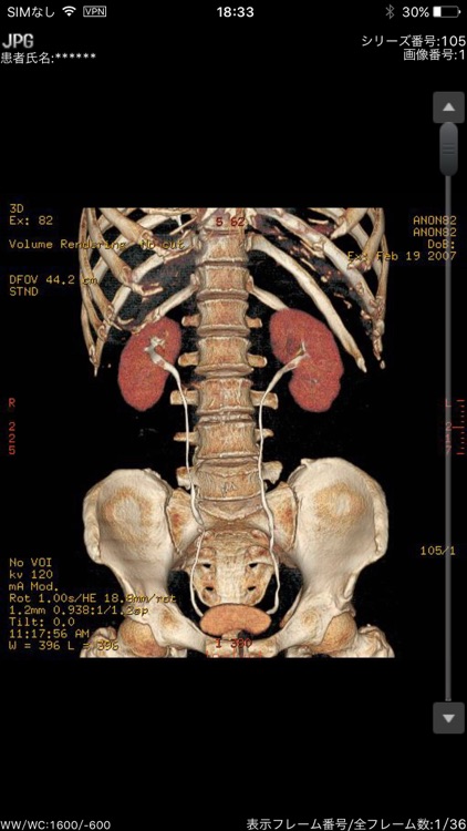 infomity 連携BOXモバイル２