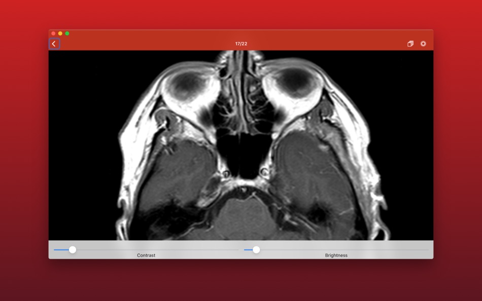 #2. DICOM Spectator (macOS) 由: Matthias Rudolph