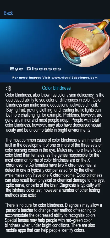 My Eye Anatomy
