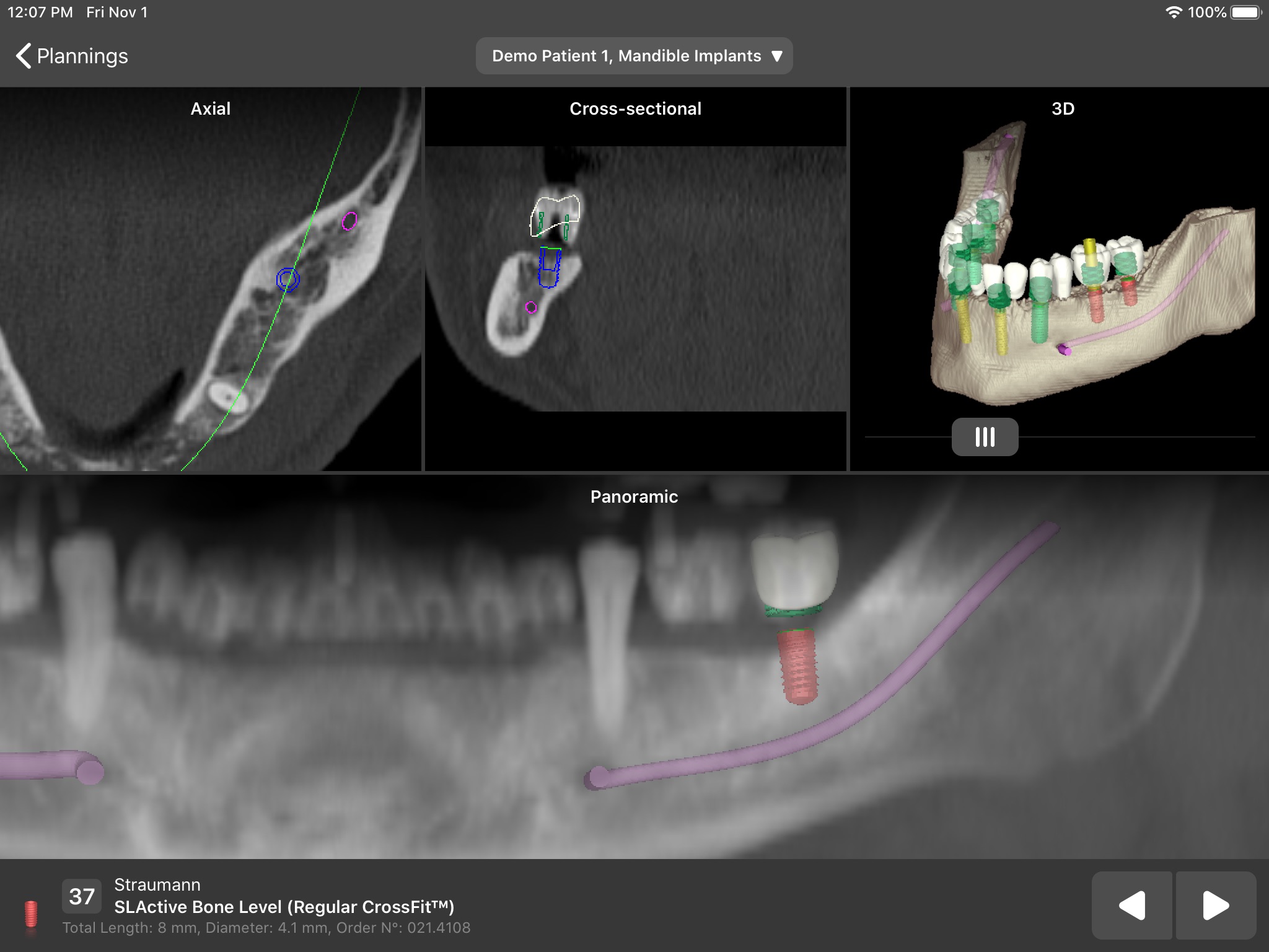 coDiagnostiX screenshot 2