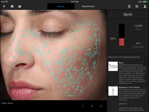 VISIA® screenshot 3