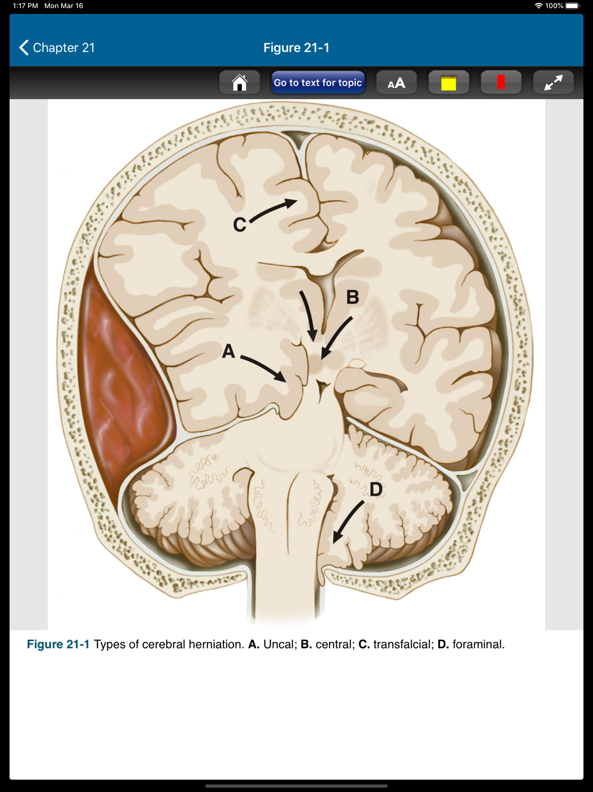 Harrison’s Manual of Med. 20/E screenshot 17