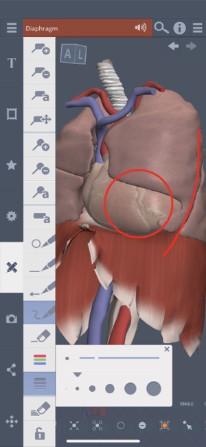 Thorax: 3D Real-time(圖5)-速報App