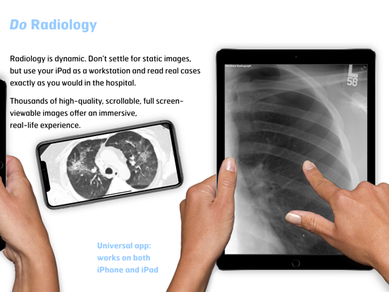 Radiology - Thoracic Imaging iPad app afbeelding 3