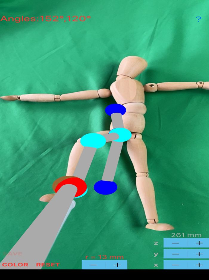 ARorthopaedicGoniometer