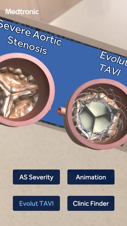 Aortic Stenosis Evolut™ TAVI