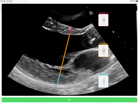 Screenshot #6 pour LVG Calc
