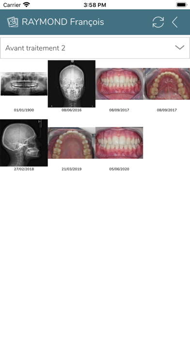 Screenshot #3 pour Dental Photos