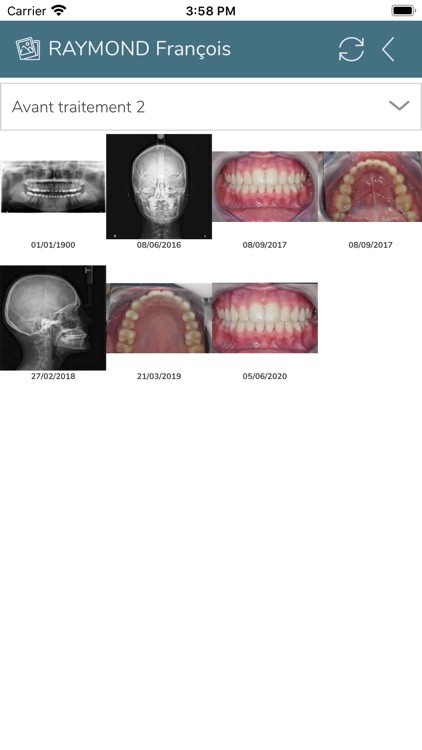 Dental Photos
