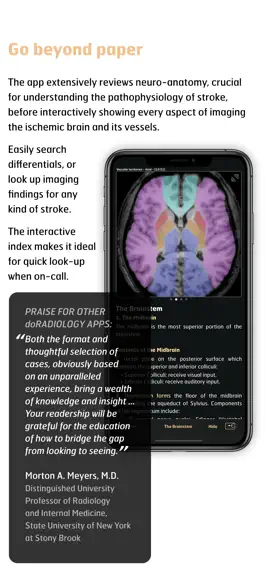 Game screenshot Radiology - Imaging in Stroke apk
