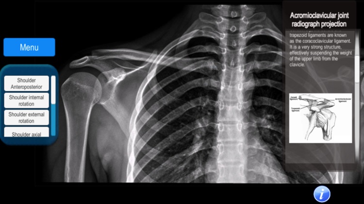 Anatomy and X-Ray Positioning