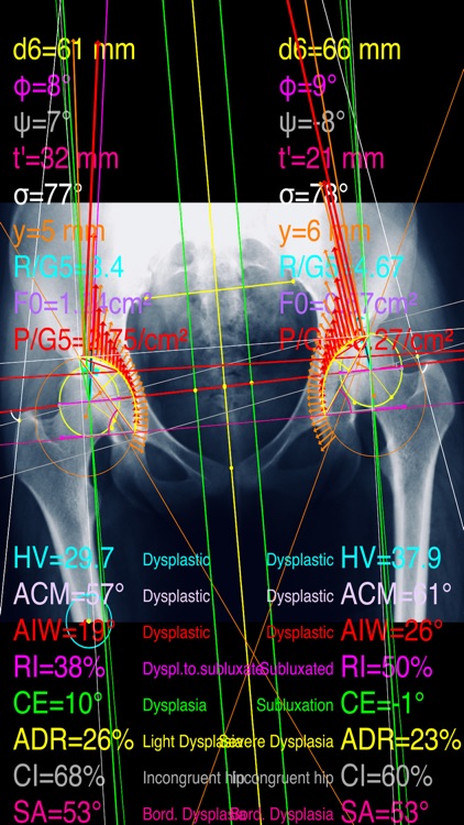 HipDysplasiaPro screenshot-8