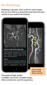 Radiology - Imaging in Stroke screenshot