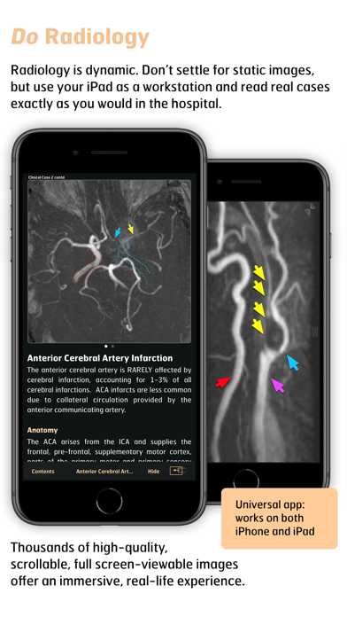 Screenshot #3 pour Radiology - Imaging in Stroke