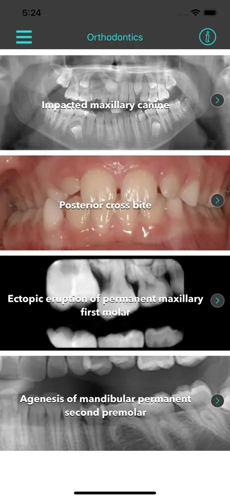 Interceptive Orthodontics
