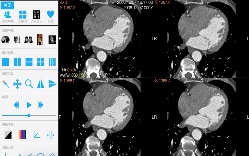 Dicom3D - Easy and Powerful screenshot 4