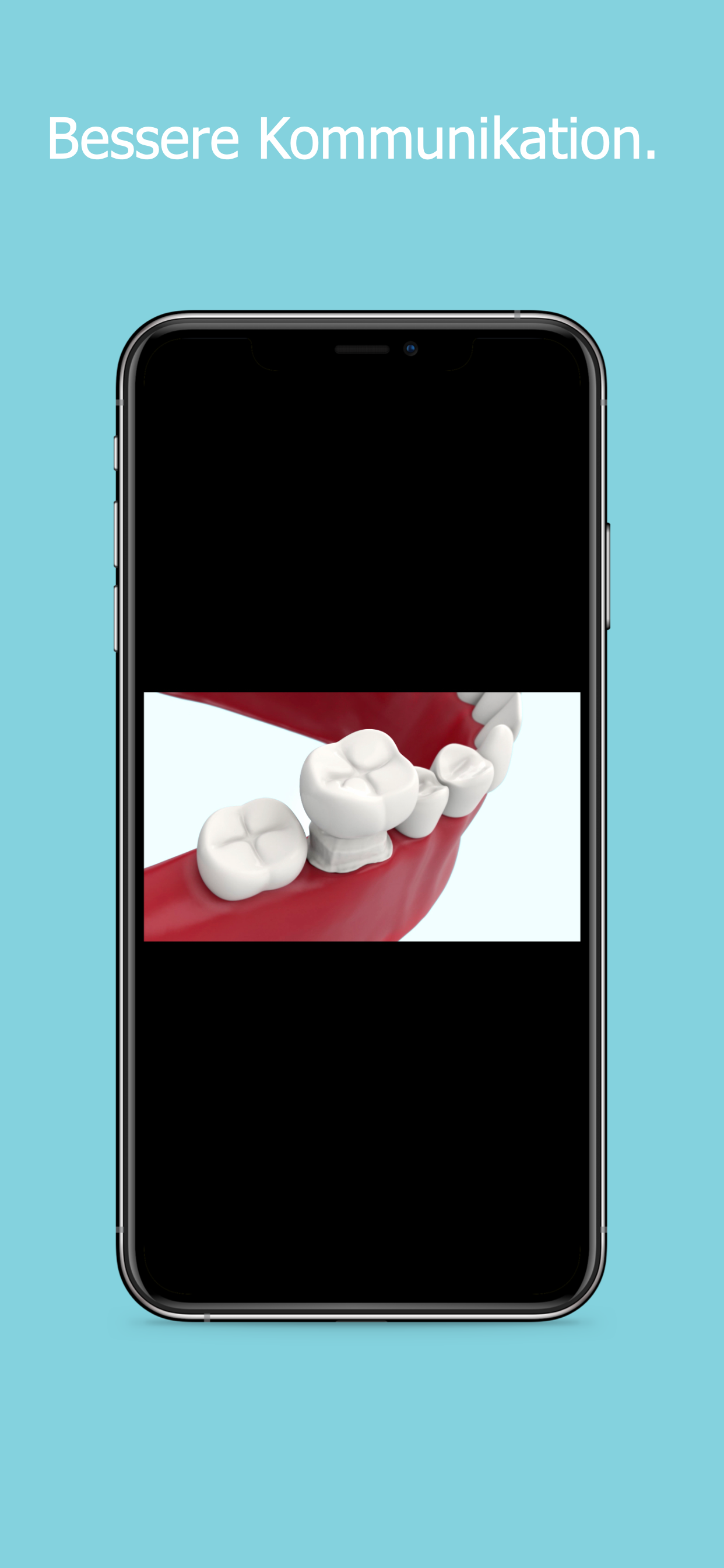 DentXplain