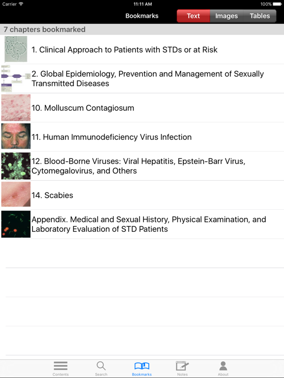 Screenshot #5 pour Color Atlas & Synopsis STDs 3E