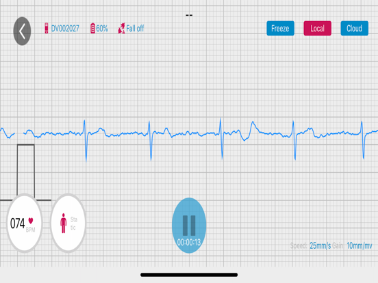 Screenshot #4 pour RhythmWatch Doctor