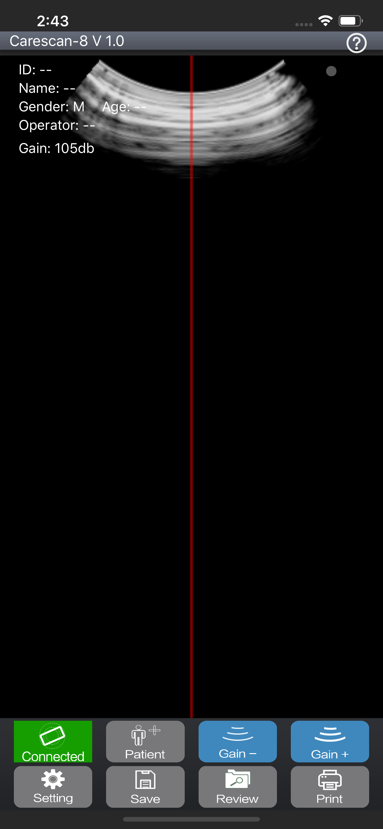 BladderUSG