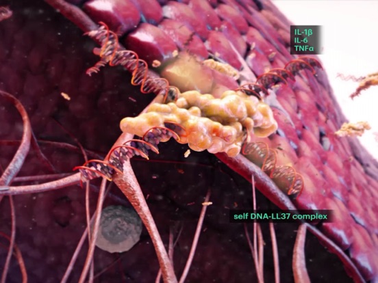 Screenshot #5 pour Psoriasis Deep Dive