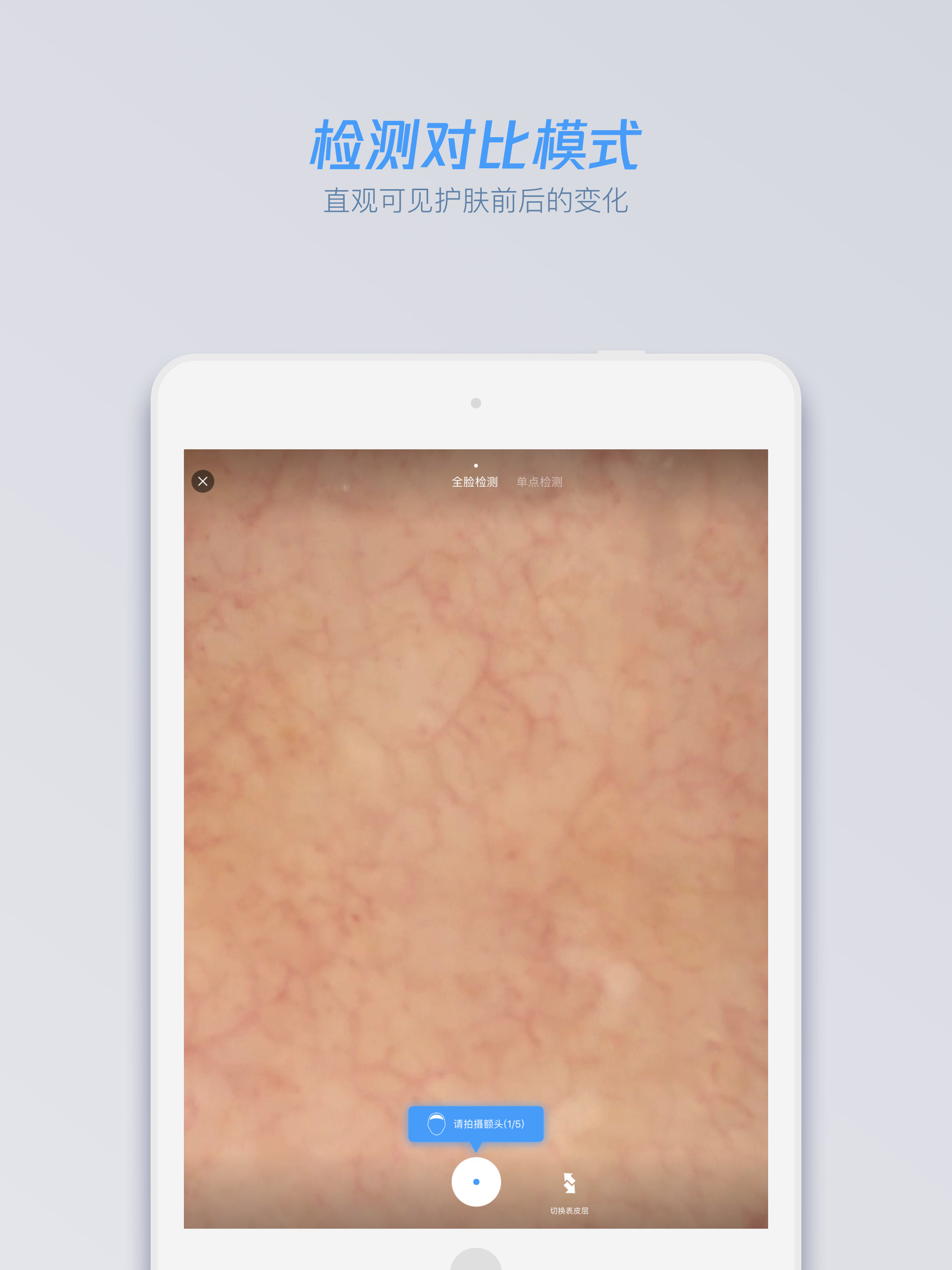 xSkin - Enterprise