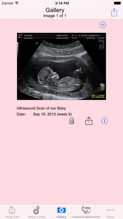 Pregnant Dad screenshot-4