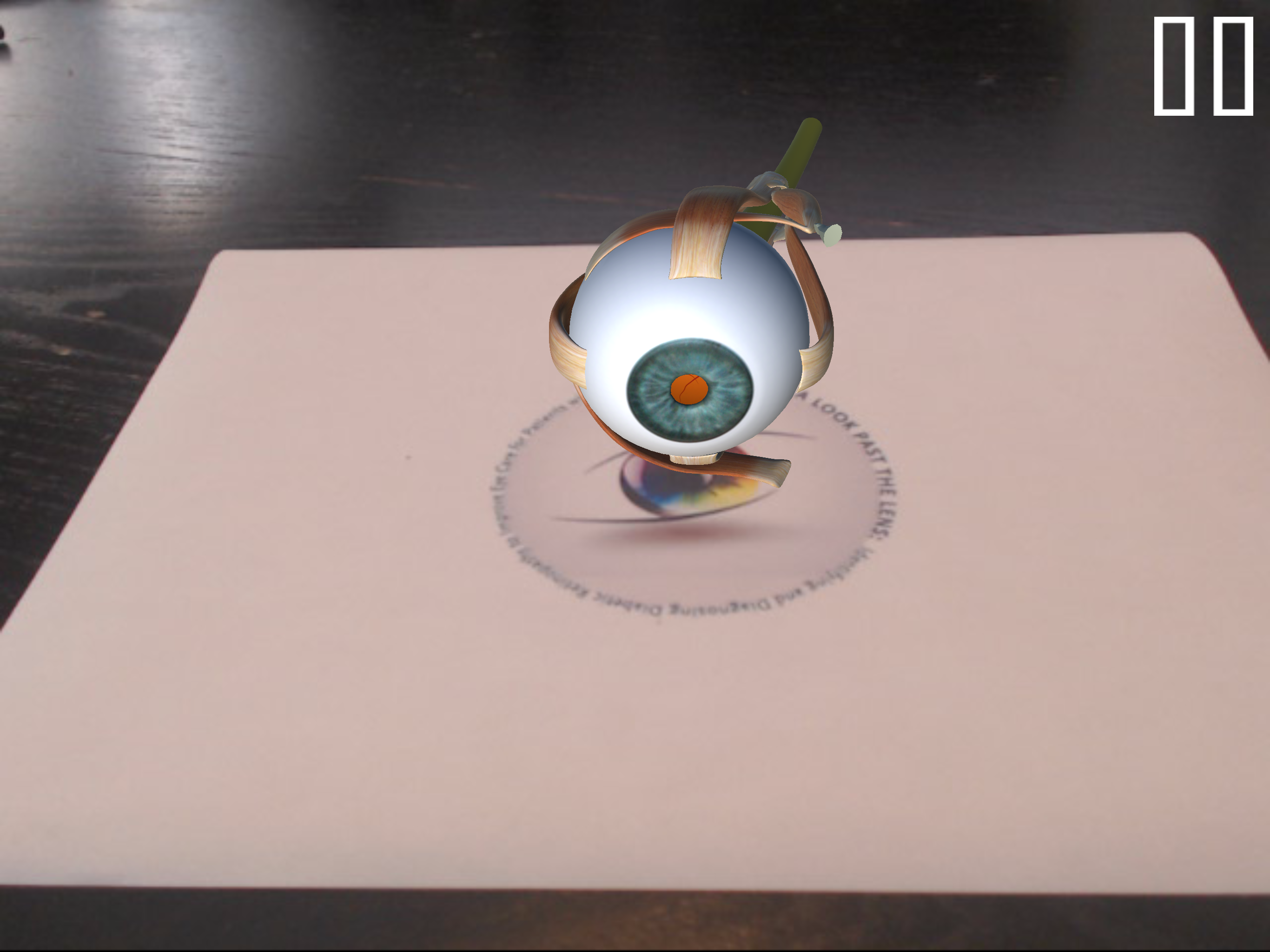 Diabetic Retinopathy AR