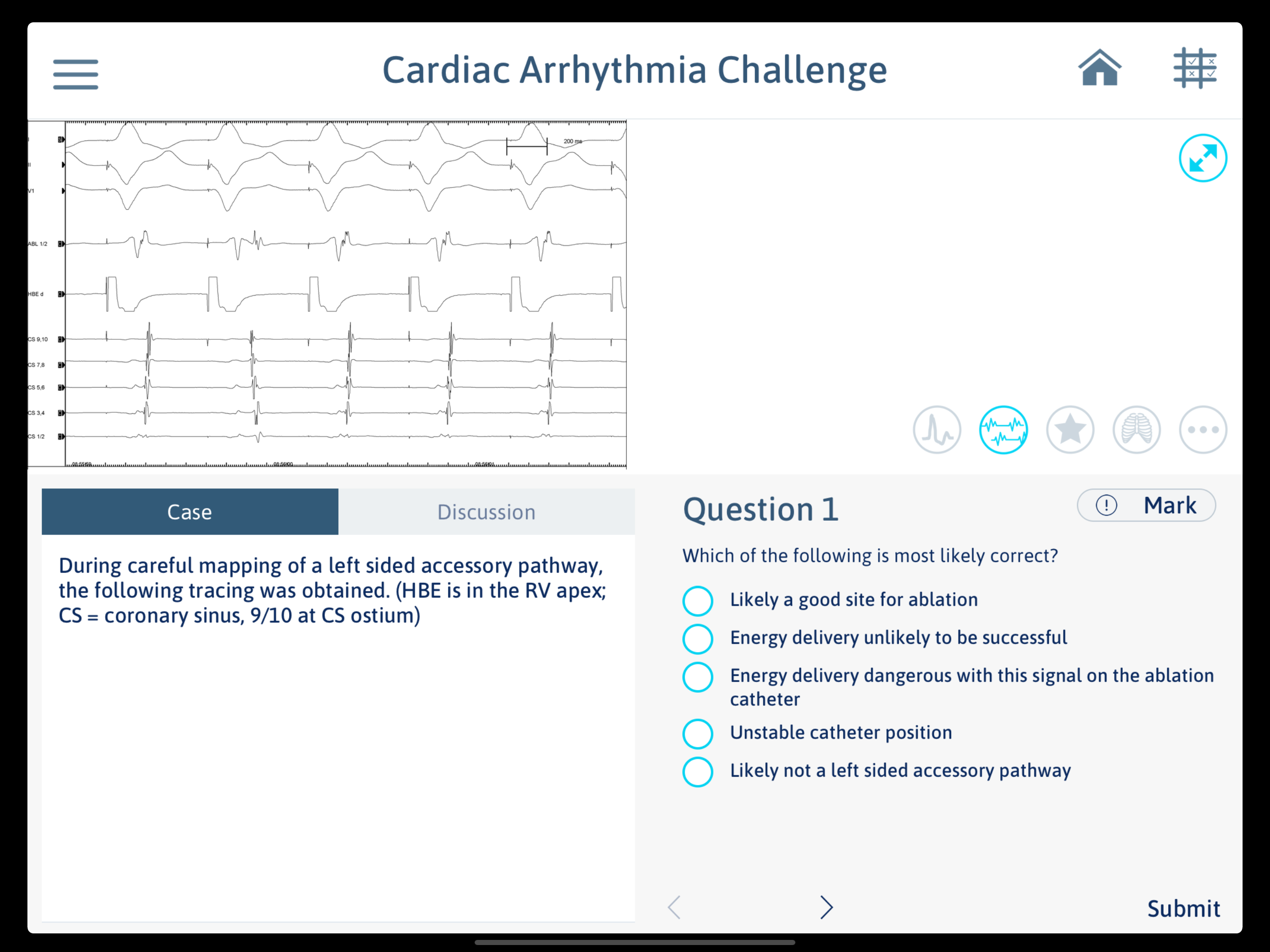 Cardiac Arrhythmia Challenge screenshot 6