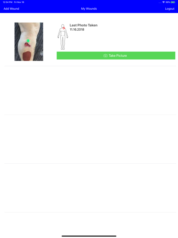 Screenshot #6 pour MobileWoundCare for Patients