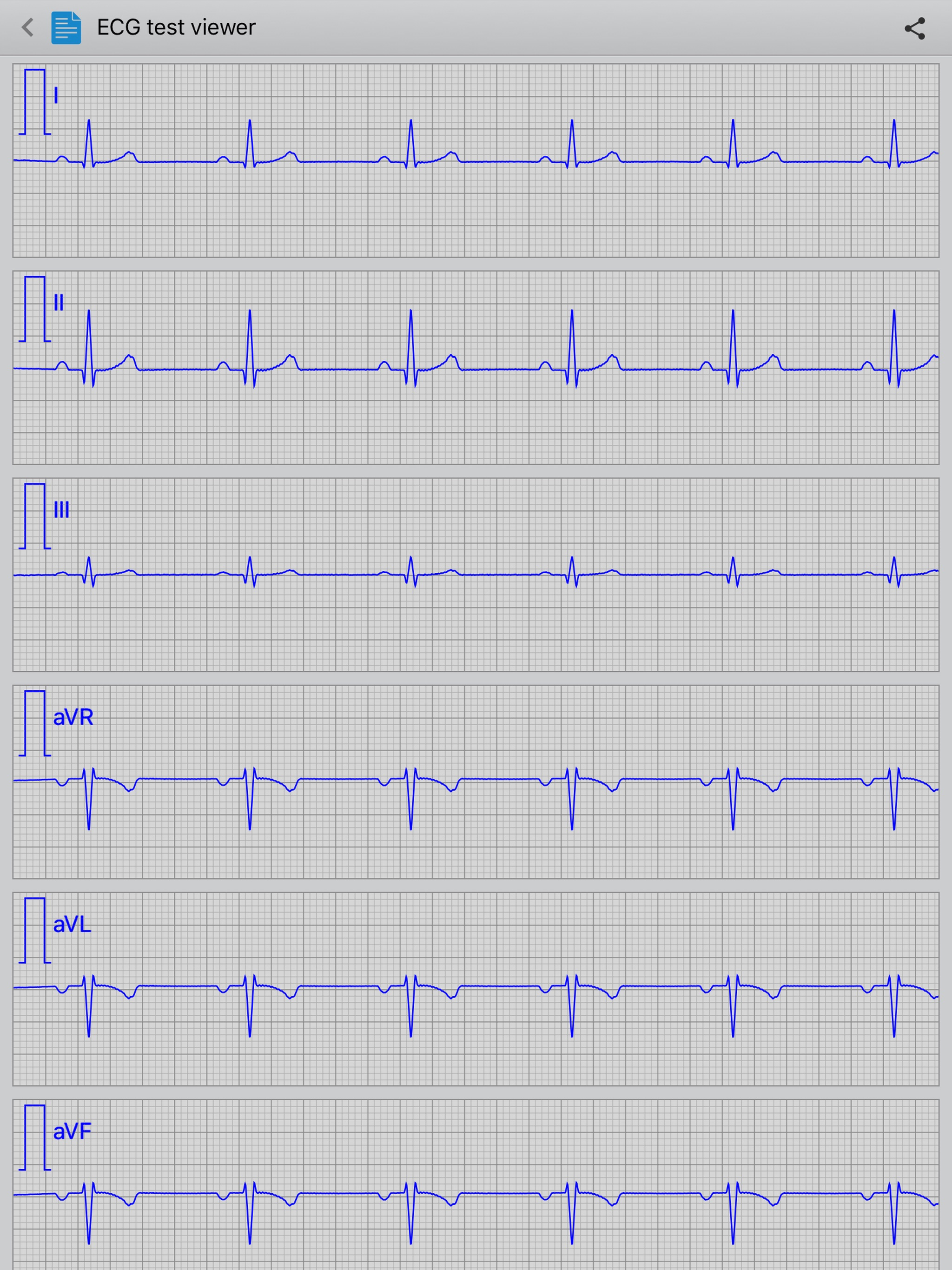 Istel ECG screenshot 6
