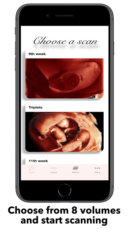 ScanBaby learn baby ultrasound screenshot-3